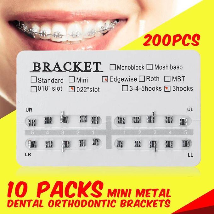 How Much Do Metal Braces Cost in Kenya: Cost of Dental Braces In