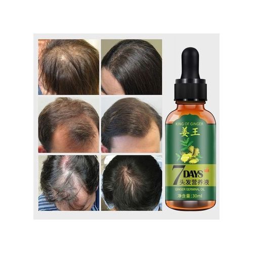 Ginger Hair Growth Prevent Hair Loss Repair Damaged Hair--