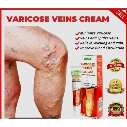 Varicose Vein Cream - Spider Vein Treatment, Leg Circulation & Pain Relief, Skin Firming