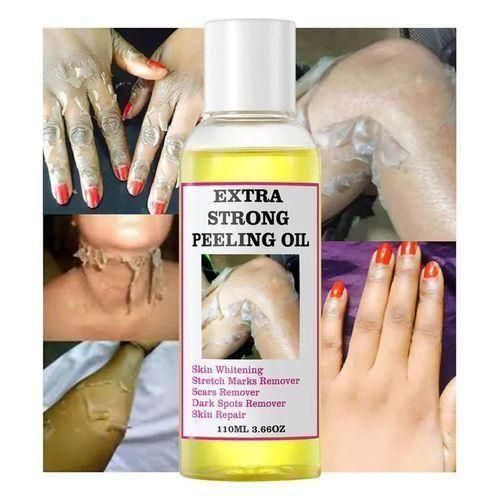 Extra Strong Peeling Oil Elbows Knees Hands Even Complexion